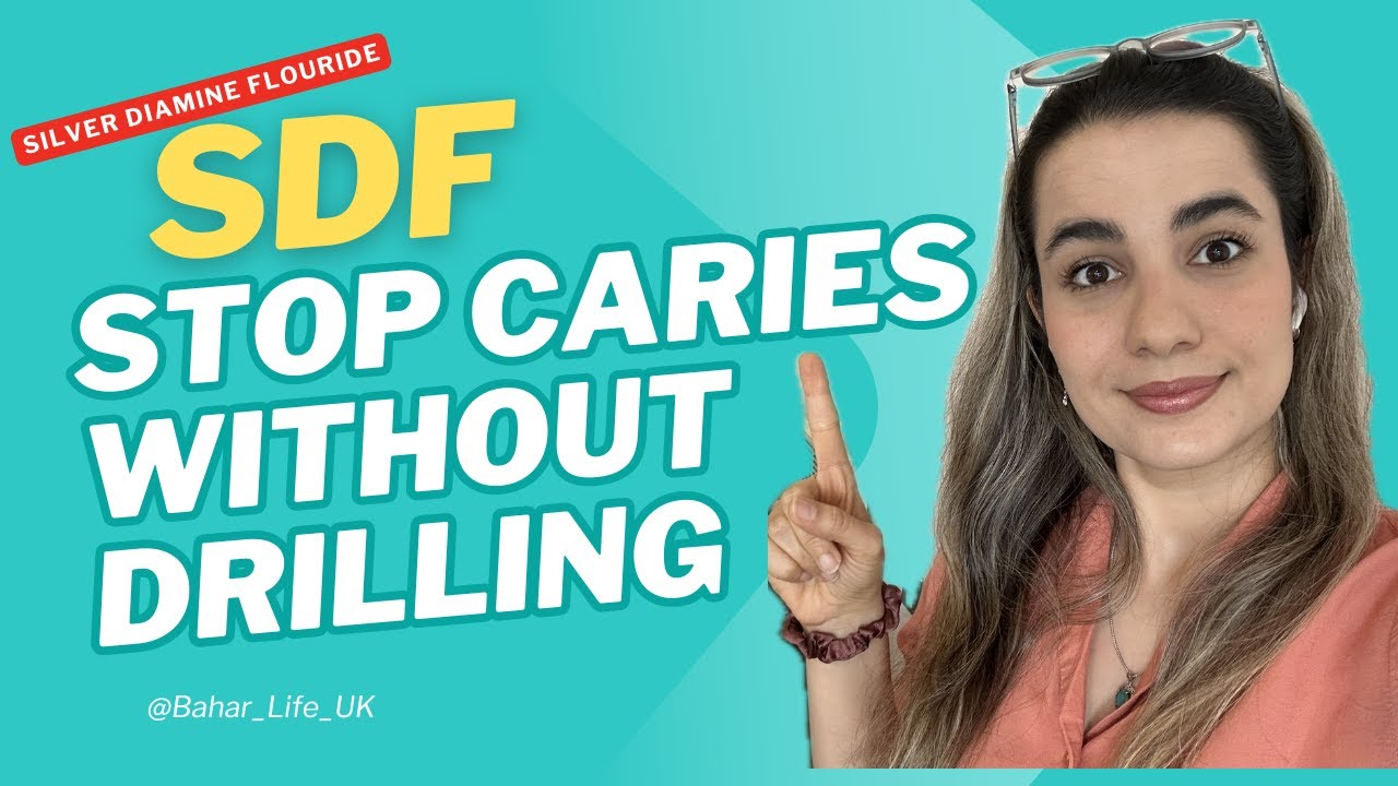 Silver Diamine Fluoride (SDF): The Drill-Free Way to Stop Cavities