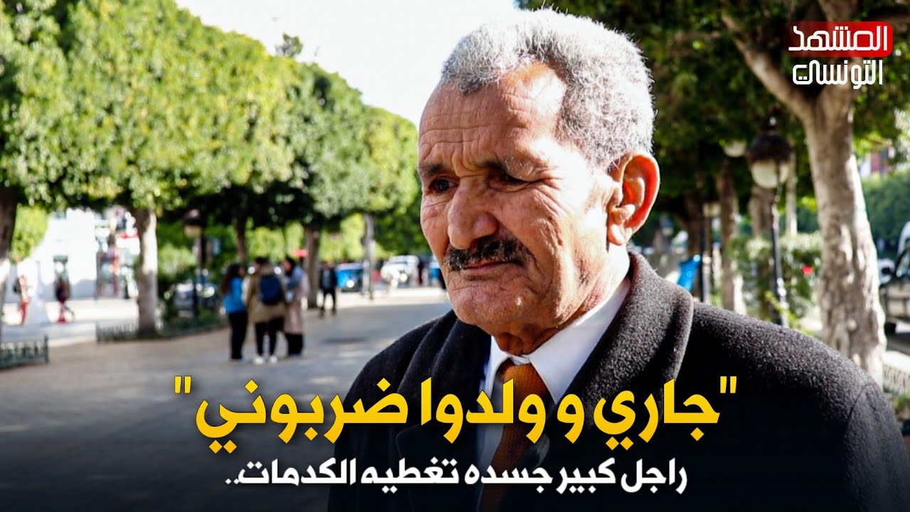 راجل كبير جسده تغطيه الكدمات.. "جار و ولدوا ضربوني 