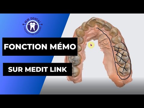 Comment utiliser la fonction capture d'image et mémo sur Medit Link
