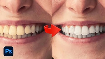 How to Whiten The Teeth Using 2 minutes in Photoshop 2025 | Photoshop Tutorial