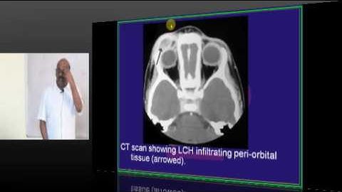 NEETPG Image based MCQ Mock Test Discussion 1499 Lec 01