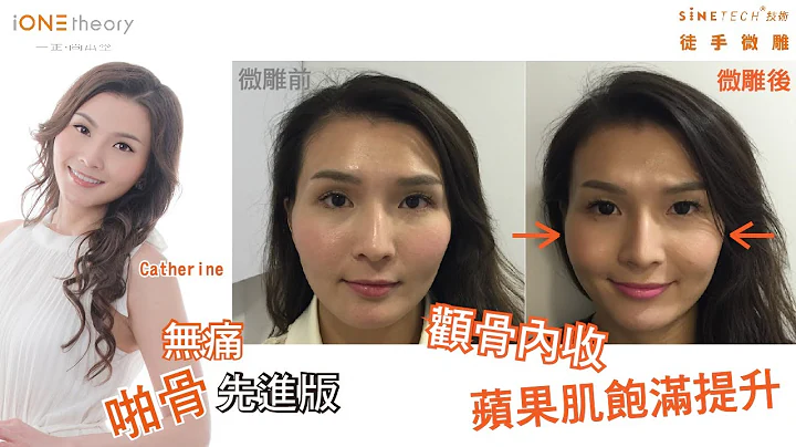 【太阳穴凹陷】影响人际关系? 【颧骨突出】感觉很恶?  自然疗法知多D！ - 天天要闻
