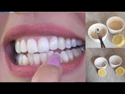 خلطة سعيدة شرف بكيس خميرة حولي أسنانك من صفراء مقرفة إلى بيضاء كالثلج | تبييض الأسنان مع إسقاط الجير. 