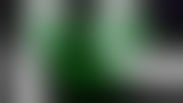 Percutaneous Pinning of Supracondylar Humerus Fractures