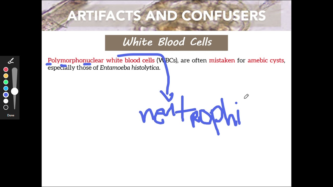 MT Pre-Recorded Lectures | MT 26: Artifacts and Confusers