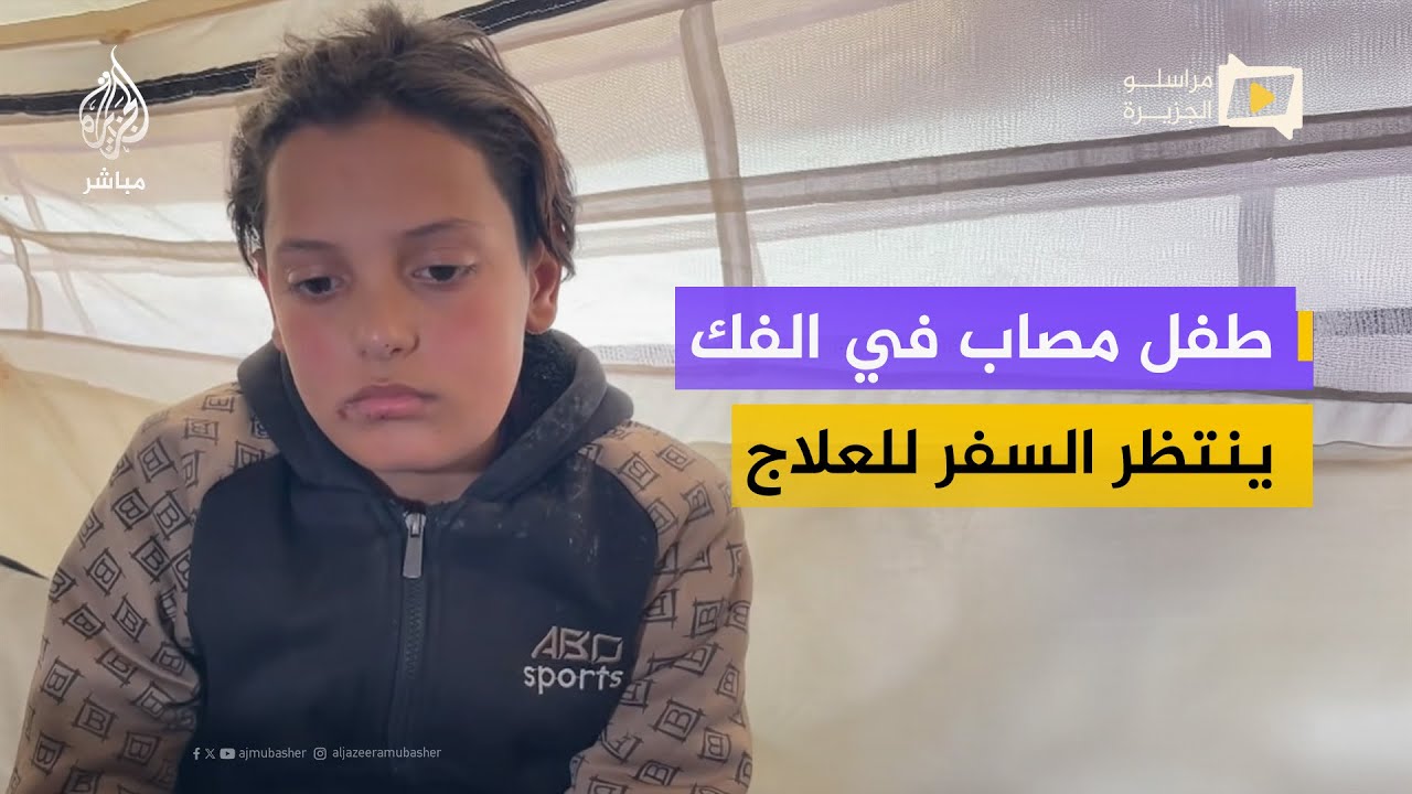 أثناء محاولته الحصول على المساعدات.. طفل يفقد النطق إثر إصابة في الفك