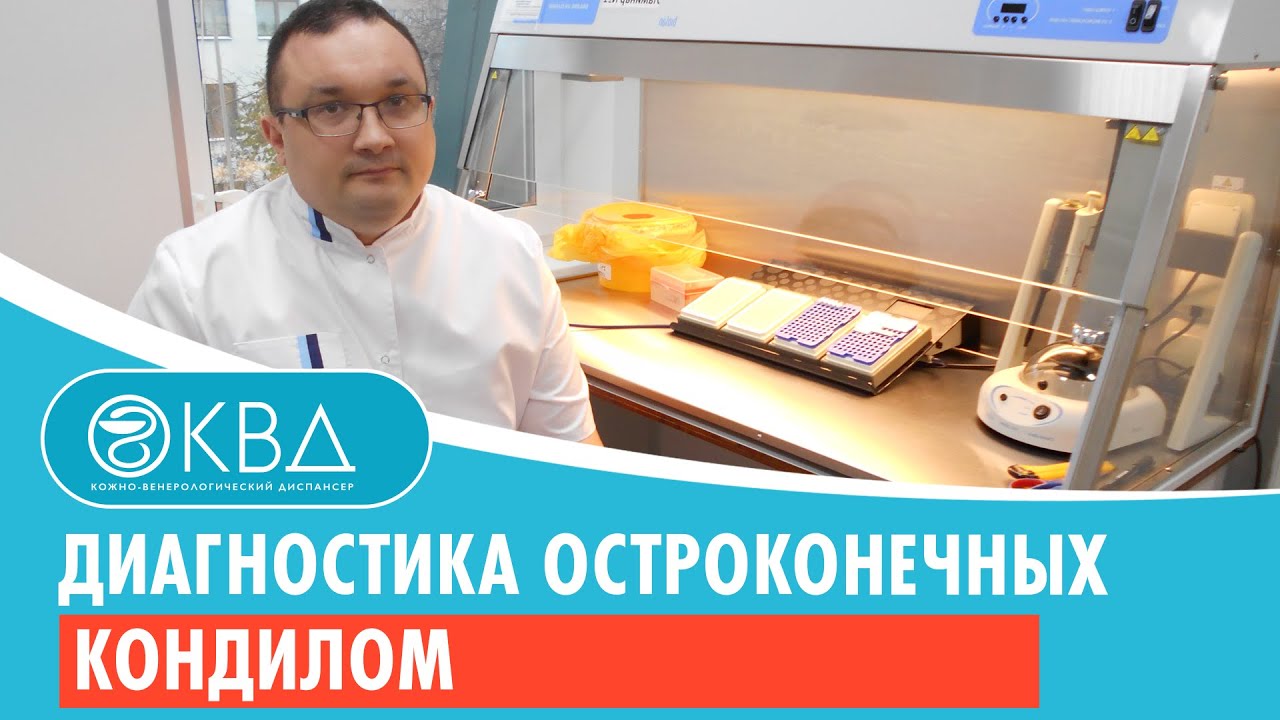 Диагностика остроконечных кондилом