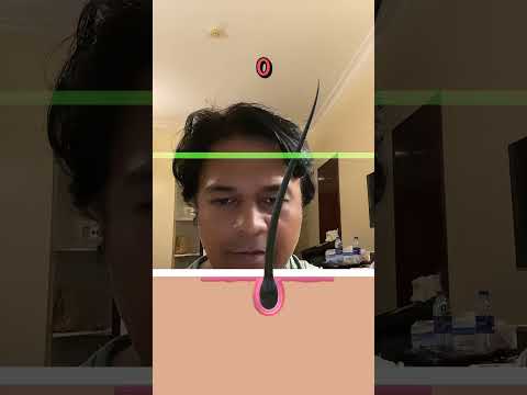 Filterchallenge Funfilter Trendingfilter