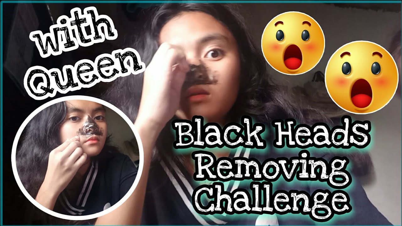 REMOVING BLACK HEADS CHALLENGE WITH QUEEN.