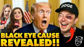 Elon's Mysterious BLACK EYE in Oval Office Stuns Media, Musk's Response to Reporter Makes Room ROAR