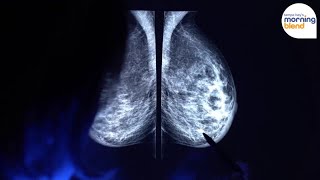 New Research Shows Most Women Unaware About the Link Between Breast Density & Cancer