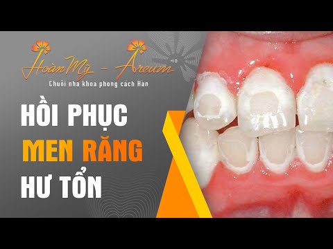 Video: Làm thế nào để phục hồi men răng (có hình ảnh)