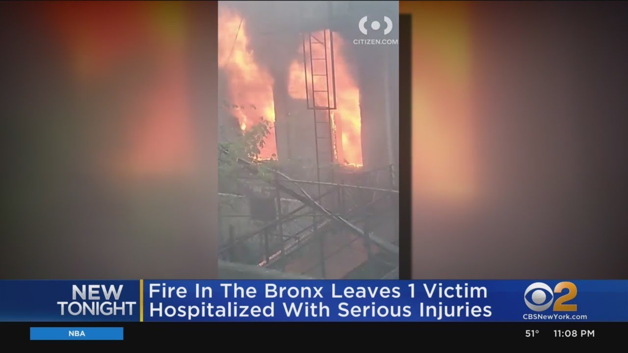 Fire In The Bronx Leaves 1 Victim Hospitalized With Serious Injuries