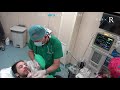 Easy waking up after general anesthesia anesthesiologist wakes up patient after rhinoplasty surgery