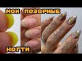 Торцы-плюшки 😭 Топовый корейский дизайн 😍 Мои убитые ногти /Наращивание на себе