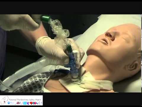 Closed suction of a tracheostomy tube - YouTube