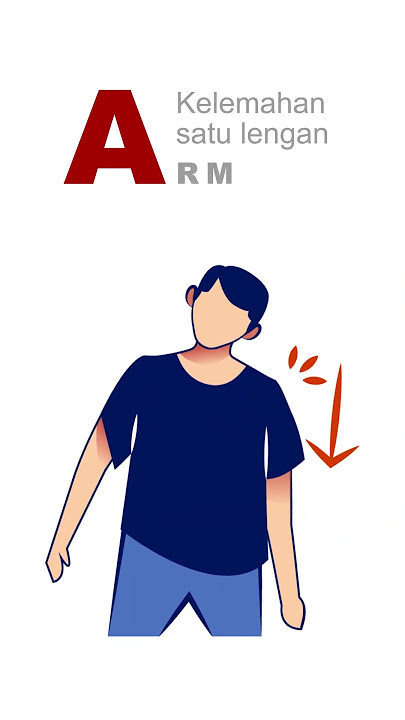 Tanda Awal STROKE ( F A S T ) #SIAGASTROKE