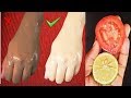 Skin Whitening Home Remedies Lemon, Colgate Toothpaste and Tomato Facial