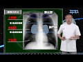 Dr.長尾の胸部X線ルネッサンス サンプル動画 - 臨床医学チャンネルCareNeTV
