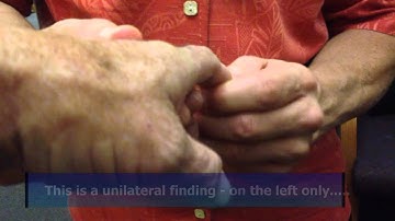 Radiculopathy   Part 2 Hoffman Reflex   Perry J. Carpenter DC QME  www.ezqmeceu.com