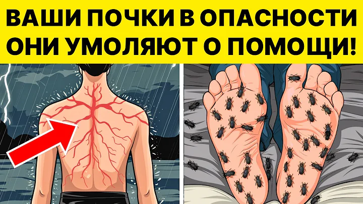 8 СТРАННЫХ ПРИЗНАКОВ, ЧТО ВАШИ ПОЧКИ ПРОСЯТ О ПОМОЩИ!