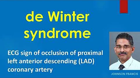 de Winter Syndrome