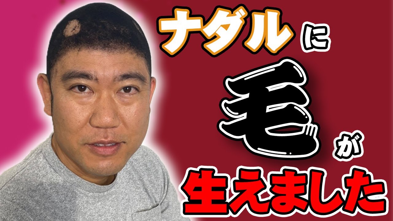 初解禁 ハゲ坊主が少しずつ増毛したら相方はいつ気づく ドッキリ コロチキ Youtube 初解禁 ハゲ坊主が少しずつ増毛したら相方はいつ気づく ドッキリ コロチキ Youtube