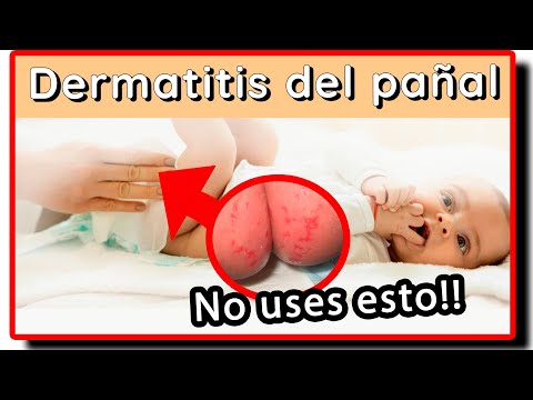 Video: ¿Cuánto tiempo tarda en desaparecer la dermatitis del pañal?