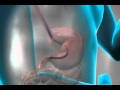 Helpful Tips For Acid Reflux And Its Symptoms