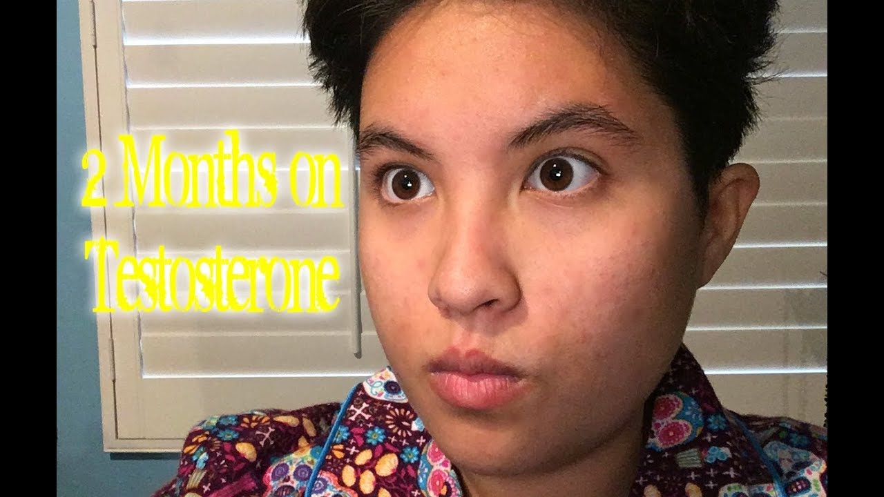 2 Months on Testosterone