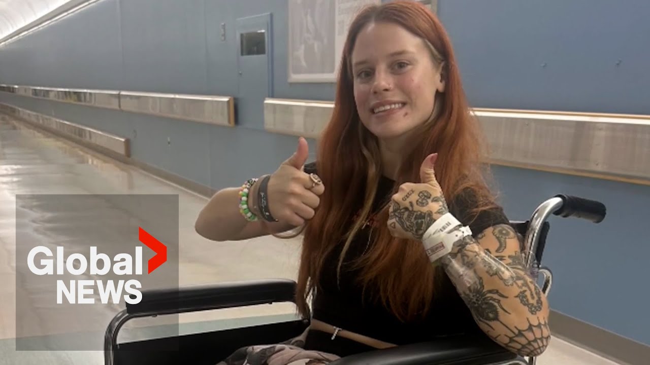 Young woman recovering after devastating crash severs both legs - YouTube