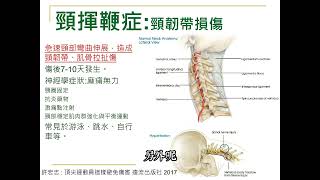 頸椎揮鞭症