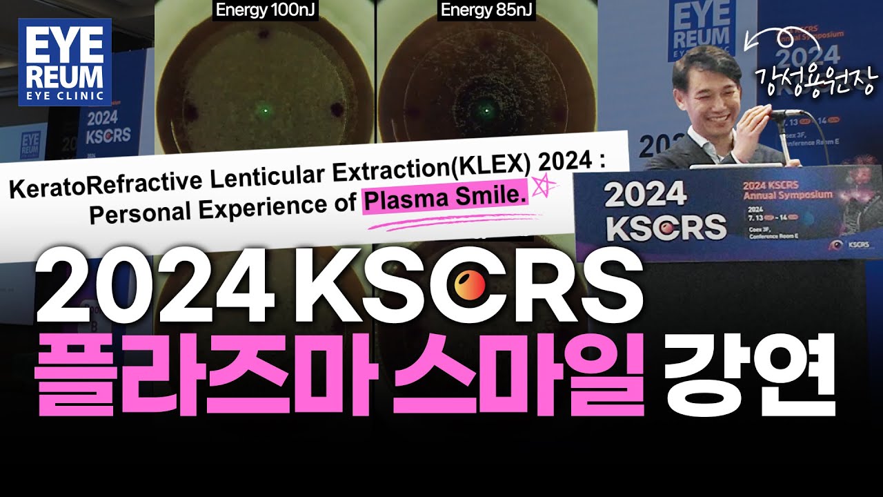 [艾麗姆眼科診所] #低能量SMILE雷射 典範完成, #電漿SMILE雷射 ( #康成勇院長 #2024KSCRS )