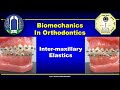 Intermaxillary Elastics in Orthodontics