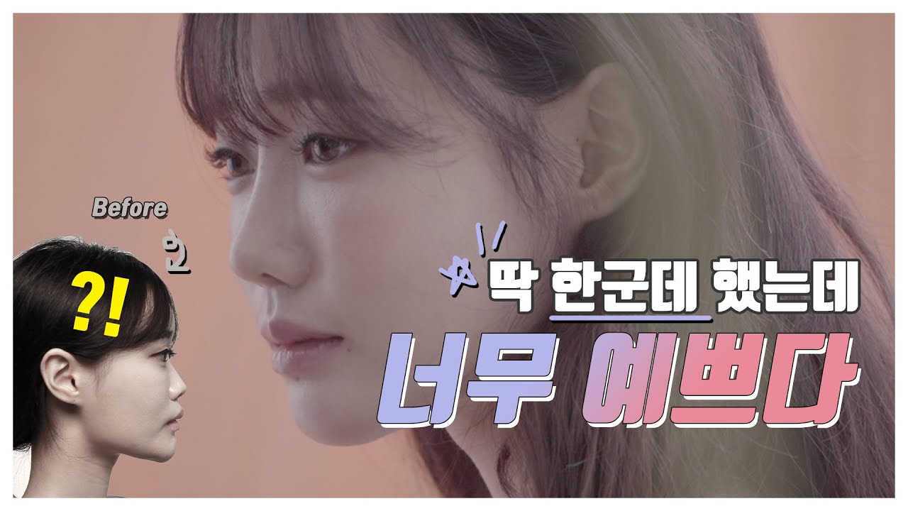 ❤JK코성형❤ 코만 달라져도 인상이 달라지는 이유 💐