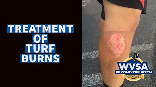 How Youth Soccer Players Can Treat Turf Burn How Long Does A Turf Burn Take To Heal