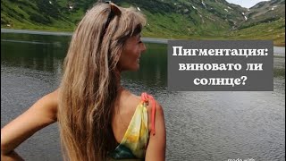 Пигментация  Виновато ли солнце