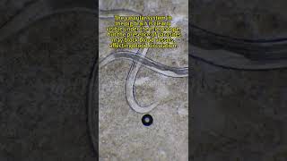 Pig brains at 400X magnification are really awesome! Wealth