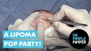 A Lipoma Pop Party!