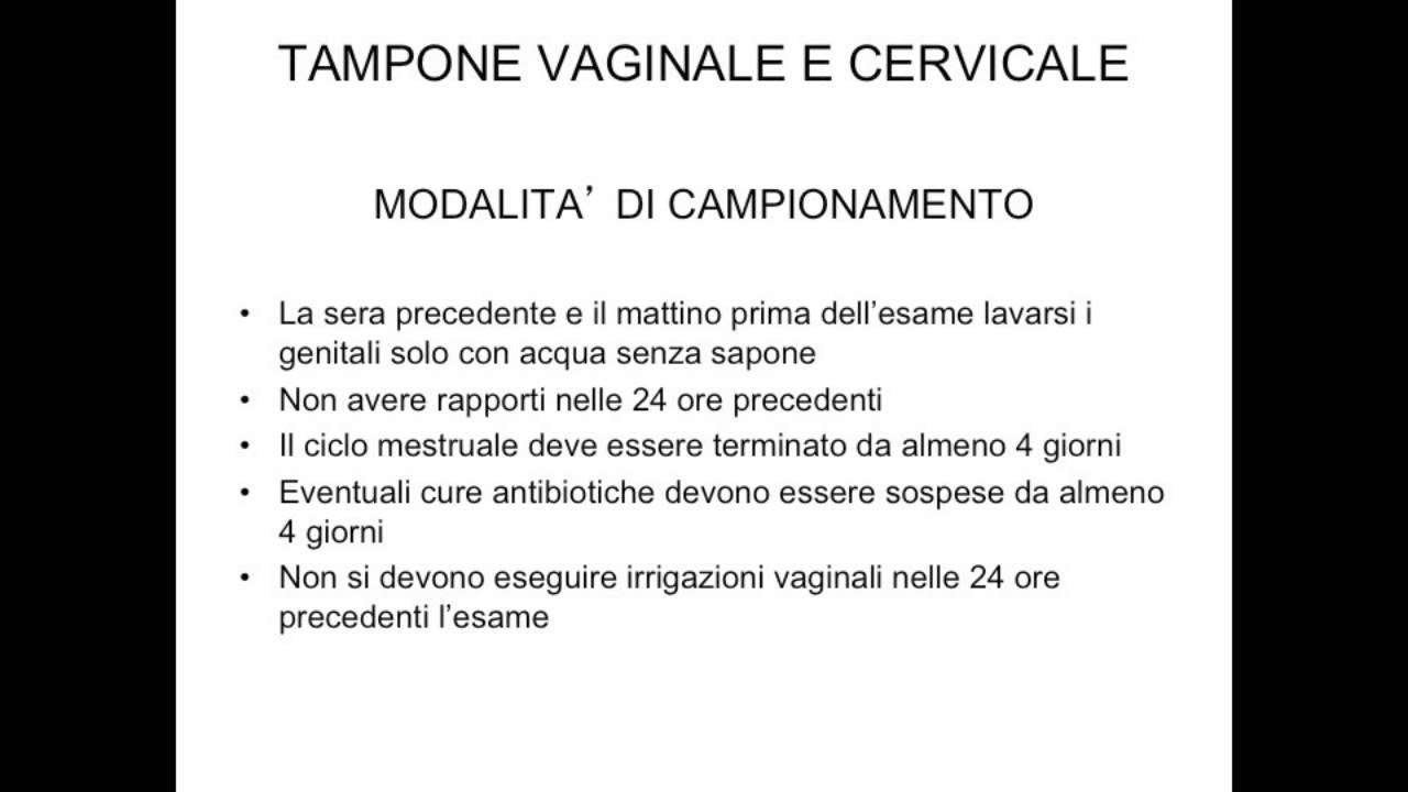 uretrite e perdite bianche uretrite e perdite bianche