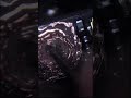 iphone x kendala baut