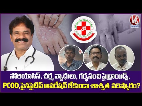 Eshwarappa Homeo Clinic - All Type Of Diseases Will Be Cured | Dandepu Baswanandam | V6 News - V6NEWSTELUGU