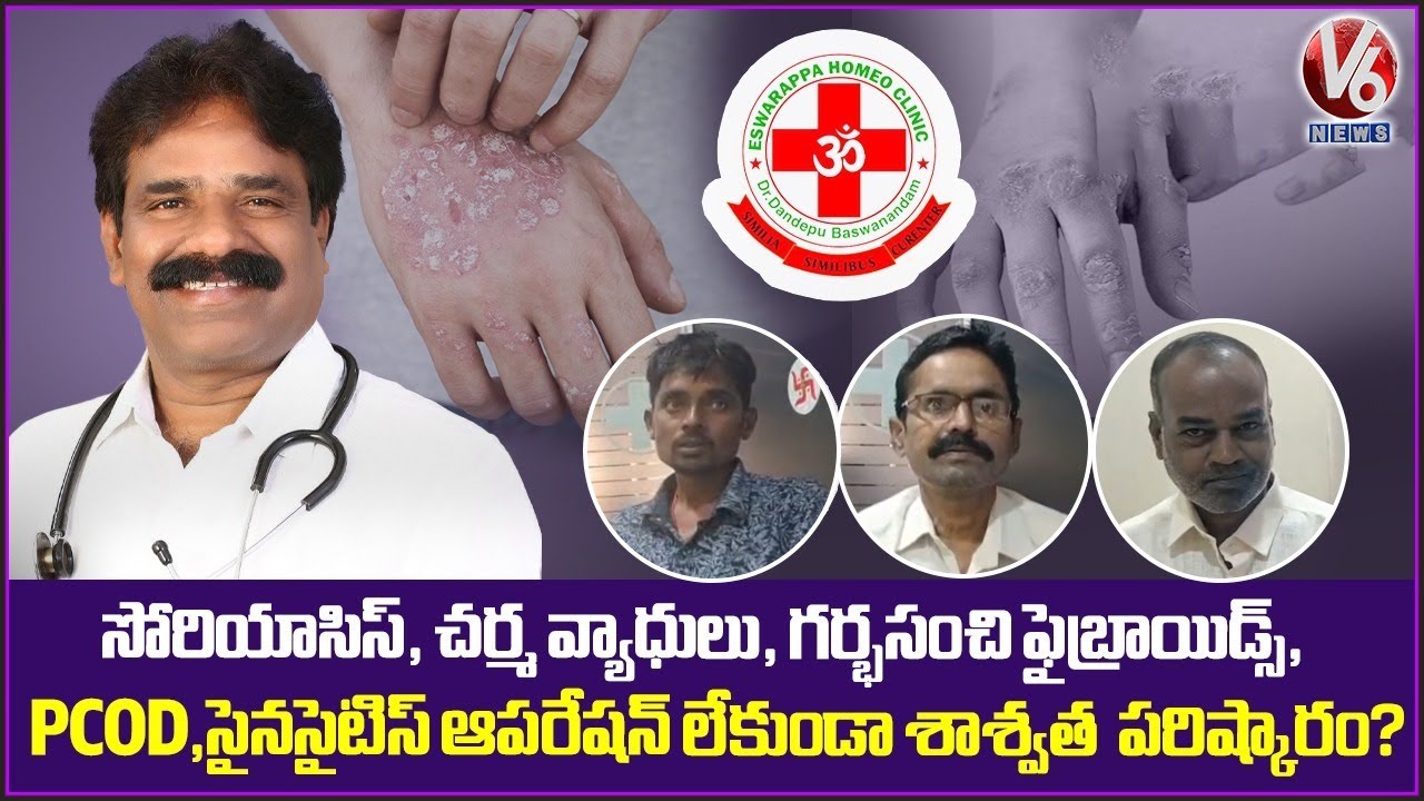 Eshwarappa Homeo Clinic - All Type Of Diseases Will Be Cured | Dandepu Baswanandam | V6 News