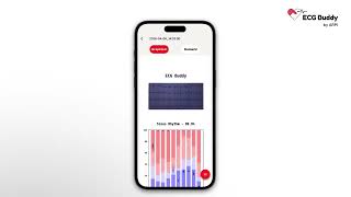 From ECG Image to AI Analysis in Seconds [Smartphone App] | ECG Buddy by ARPI