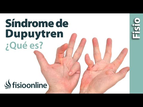 Video: ¿Qué provoca que se partan las puntas de los dedos?