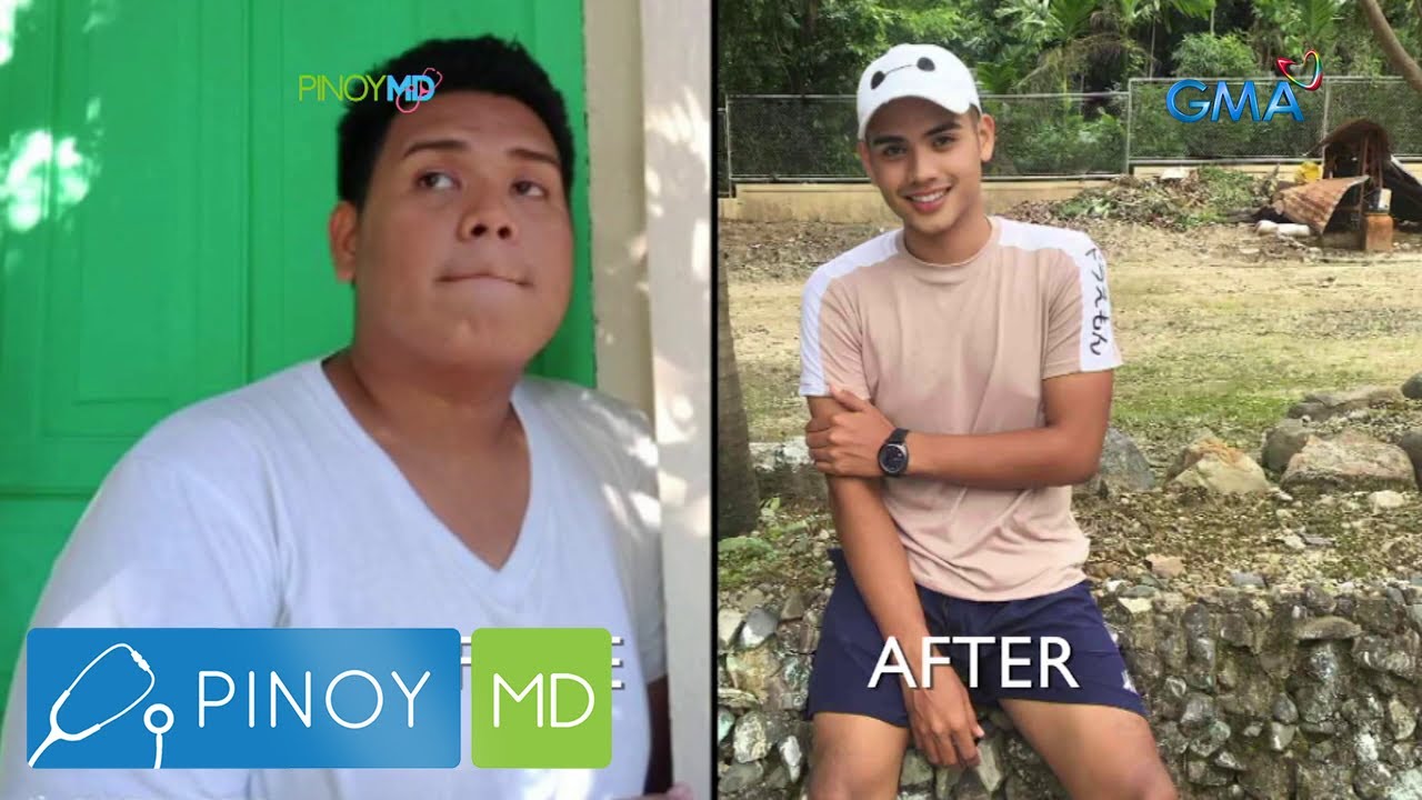 Intermittent fasting, epektibo nga ba sa pagbabawas ng timbang? | Pinoy MD