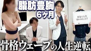 【骨格ウェーブ必見】脂肪豊胸で人生のコンプレックス消滅！6ヶ…のサムネイル