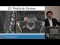 Minimally Invasive Posterior Instrumentation - Choll W.  Kim, MD PhD