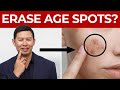 The Truth About Age Spots (and How to Get Rid of Them)