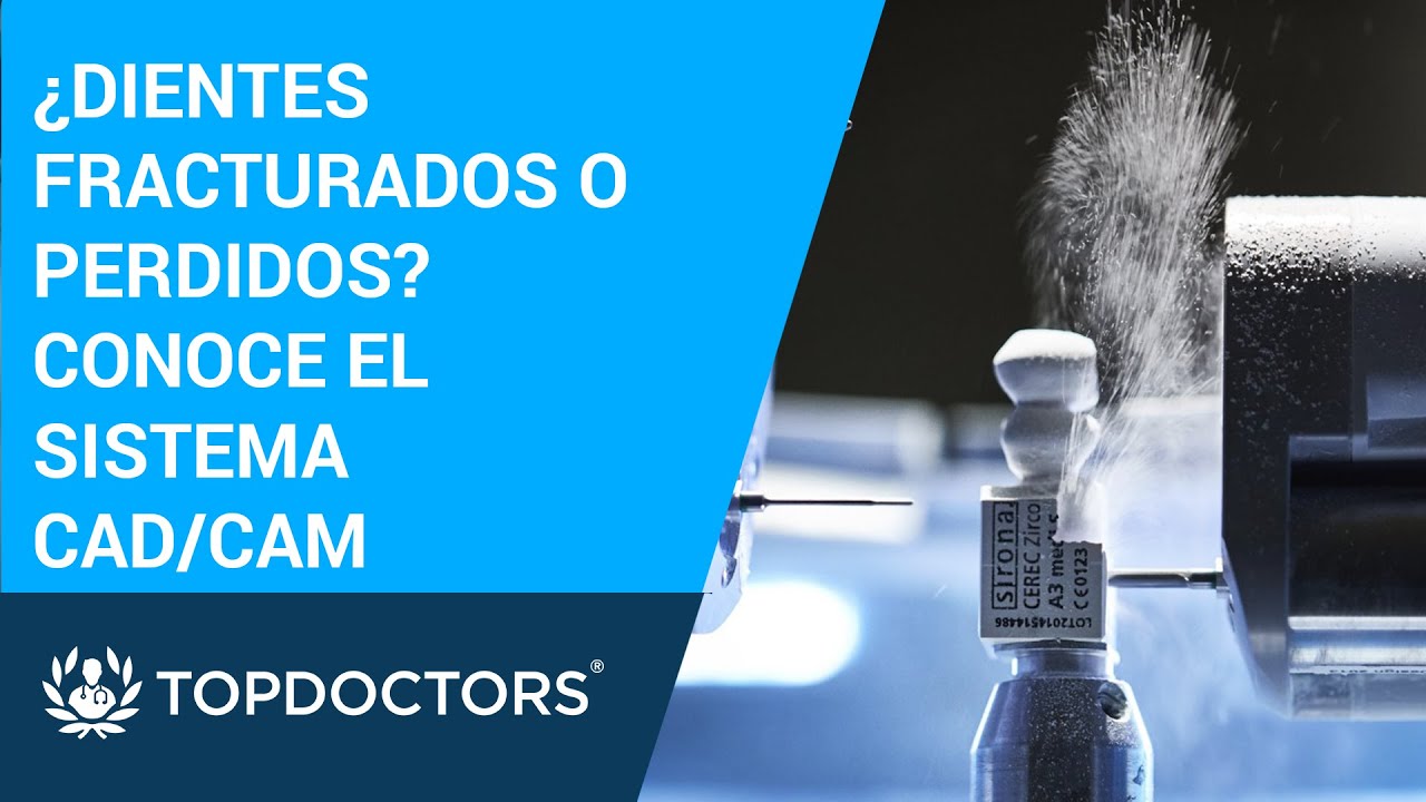 ¿Qué es un sistema CAD/CAM Dental? - YouTube